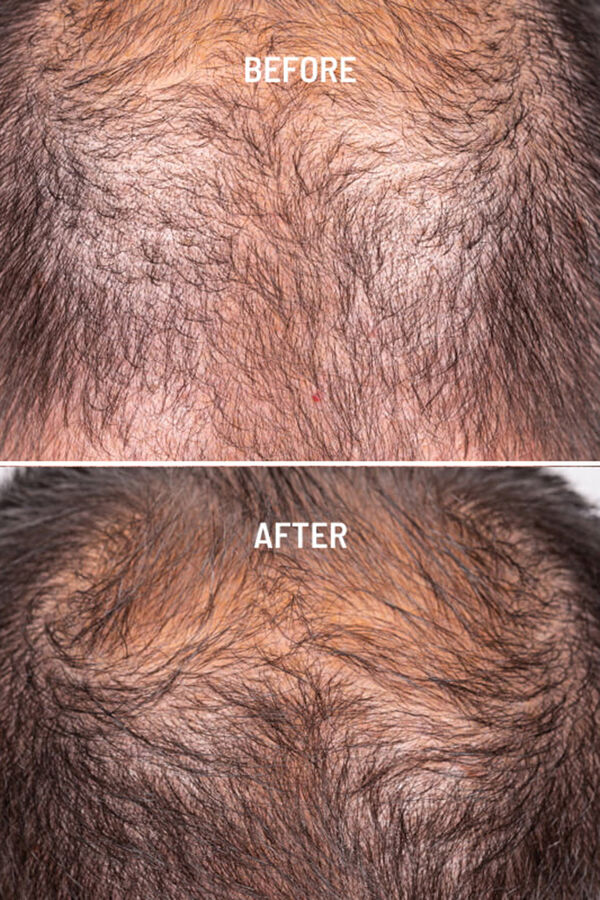 Womensecret Hair Growth & Density Treatment Weiß